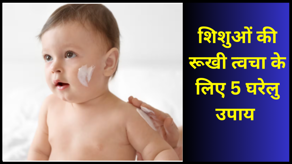 bacho ki dry skin ke liye home remedies